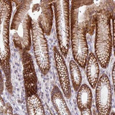 Immunohistochemistry-Paraffin: Protocadherin-1 Antibody [NBP2-48968]