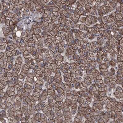Immunohistochemistry-Paraffin: Protocadherin-17 Antibody [NBP1-80943]