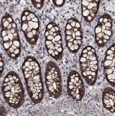 Immunohistochemistry-Paraffin: Protocadherin-17 Antibody [NBP1-80943]