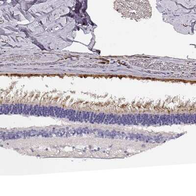 Immunohistochemistry-Paraffin: Protocadherin 21 Antibody [NBP1-92296]