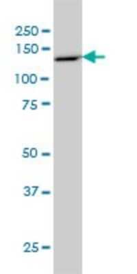 Western Blot: Protocadherin-8 Antibody (6A8) [H00005100-M01]