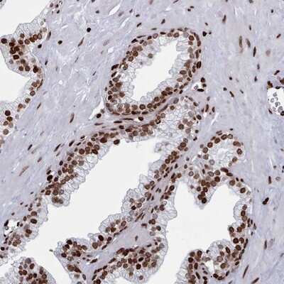 Immunohistochemistry-Paraffin: Protocadherin beta 11 Antibody [NBP2-13738]