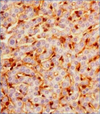Immunohistochemistry: Prox1 Antibody (5G10) - Azide and BSA Free [NBP2-80920]