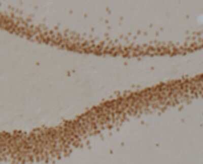 Immunohistochemistry: Prox1 Antibody (5G10) - BSA Free [NBP1-30045]