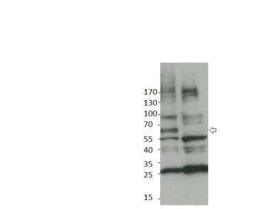 Western Blot: Punt Antibody [NBP3-12415]