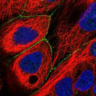 Immunocytochemistry/ Immunofluorescence: Puratrophin-1 Antibody [NBP2-56984]