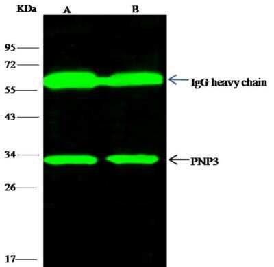 Immunoprecipitation: Purine Nucleoside Phosphorylase/PNP Antibody (103) [NBP2-90053]