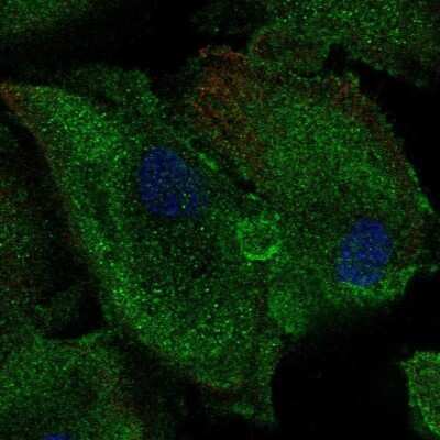 Immunocytochemistry/ Immunofluorescence: Purine Nucleoside Phosphorylase/PNP Antibody [NBP1-82541]