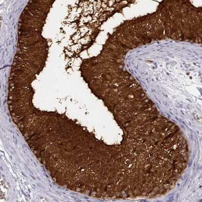 Immunohistochemistry-Paraffin: Purine Nucleoside Phosphorylase/PNP Antibody [NBP1-82541]