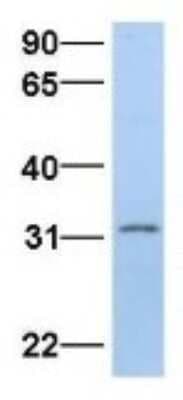 Western Blot: Purine Nucleoside Phosphorylase/PNP Antibody [NBP1-54353]