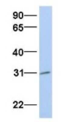 Western Blot: Purine Nucleoside Phosphorylase/PNP Antibody [NBP1-54353]