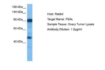 Western Blot: Puromycin-sensitive aminopeptidase/NPEPPS Antibody [NBP2-88103]