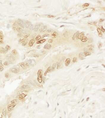 Immunohistochemistry: Pygopus-1 Antibody [NBP1-42665]