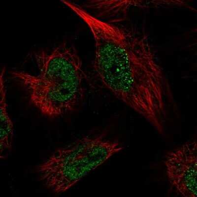 Immunocytochemistry/ Immunofluorescence: Pyridoxal Kinase/PDXK Antibody [NBP1-88283]