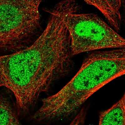 Immunocytochemistry/ Immunofluorescence: Pyridoxal Kinase/PDXK Antibody [NBP1-88284]