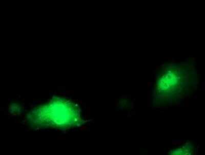 Immunocytochemistry/ Immunofluorescence: Pyridoxal Kinase/PDXK Antibody (OTI5H5) - Azide and BSA Free [NBP2-73754]