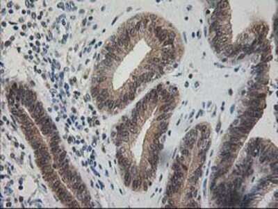 Immunohistochemistry: Pyridoxal Kinase/PDXK Antibody (OTI5H5) - Azide and BSA Free [NBP2-73754]
