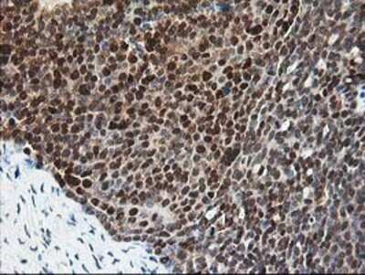 Immunohistochemistry: Pyridoxal Kinase/PDXK Antibody (OTI5H5) - Azide and BSA Free [NBP2-73754]