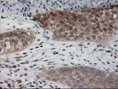 Immunohistochemistry: Pyridoxal Kinase/PDXK Antibody (OTI5H5) - Azide and BSA Free [NBP2-73754]
