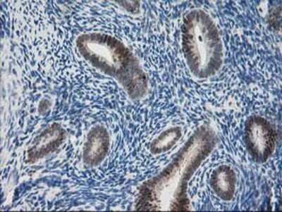 Immunohistochemistry: Pyridoxal Kinase/PDXK Antibody (OTI5H5) - Azide and BSA Free [NBP2-73754]