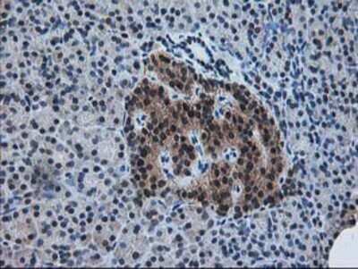 Immunohistochemistry: Pyridoxal Kinase/PDXK Antibody (OTI5H5) - Azide and BSA Free [NBP2-73754]