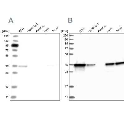 Western Blot: Pyridoxal Kinase/PDXK Antibody [NBP1-88282]