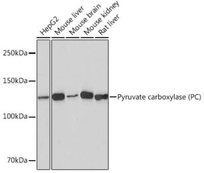 Western Blot: Pyruvate Carboxylase Antibody (10S0V1) [NBP3-16726]