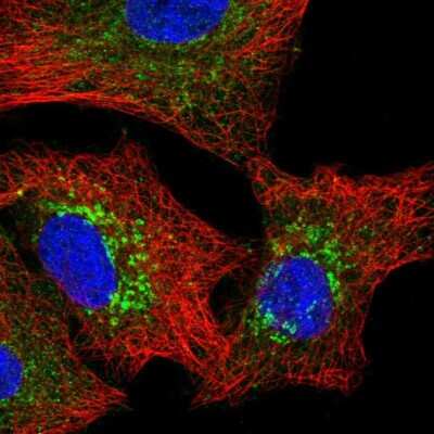 Immunocytochemistry/ Immunofluorescence: Pyruvate Carboxylase Antibody [NBP2-33407]