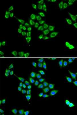 Immunocytochemistry/ Immunofluorescence: Pyruvate Carboxylase Antibody - BSA Free [NBP2-93781]
