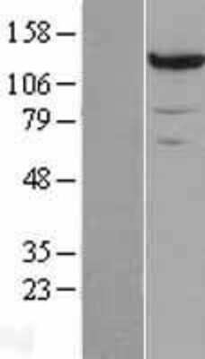 Western Blot: Pyruvate Carboxylase Overexpression Lysate [NBP2-10894]