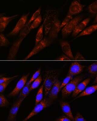 Immunocytochemistry/ Immunofluorescence: Pyruvate Dehydrogenase E1-alpha subunit Antibody (8Z4N6) [NBP3-15470]