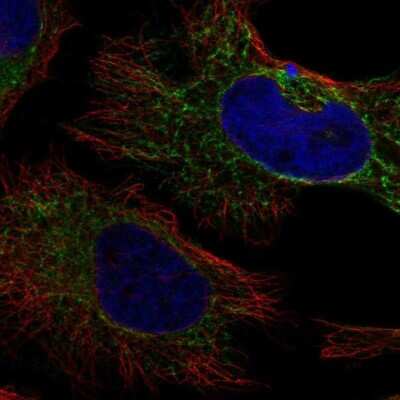 Immunocytochemistry/ Immunofluorescence: Pyruvate Dehydrogenase E1-alpha subunit Antibody [NBP2-33922]