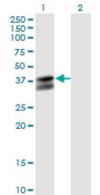 Western Blot: Pyruvate Dehydrogenase E1 beta subunit Antibody (2B2) [H00005162-M03]