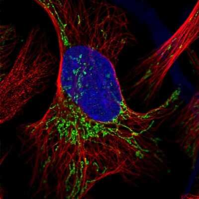 Immunocytochemistry/ Immunofluorescence: Pyruvate Dehydrogenase E1 beta subunit Antibody [NBP2-38327]