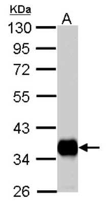 Western Blot: Pyruvate Dehydrogenase E1 beta subunit Antibody [NBP2-20024]