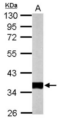 Western Blot: Pyruvate Dehydrogenase E1 beta subunit Antibody [NBP2-20024]