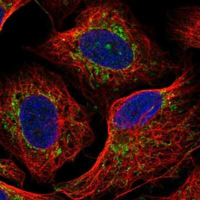 Immunocytochemistry/ Immunofluorescence: Pyruvate Dehydrogenase E2 Antibody [NBP2-56744]