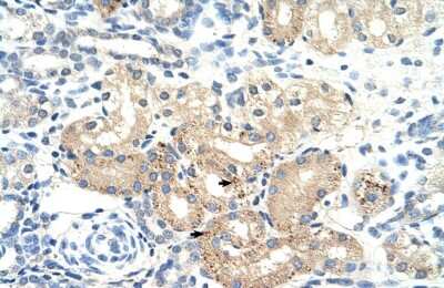 Immunohistochemistry-Paraffin: Pyruvate Dehydrogenase E2 Antibody [NBP1-54795]