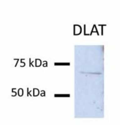 Western Blot: Pyruvate Dehydrogenase E2 Antibody [NBP1-54795]