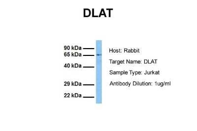 Western Blot: Pyruvate Dehydrogenase E2 Antibody [NBP1-54795]