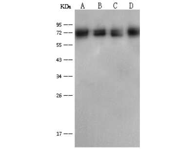 Western Blot: Pyruvate Dehydrogenase E2 Antibody [NBP2-99340]