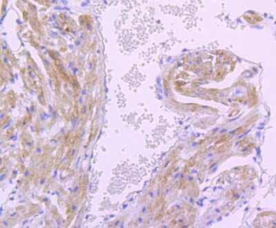 Immunohistochemistry-Paraffin: Pyruvate Dehydrogenase Kinase 1/PDK1 Antibody (JA67-30) [NBP2-67032]