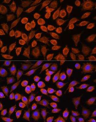 Immunocytochemistry/ Immunofluorescence: Pyruvate Dehydrogenase Phosphatase/PDP1/PPM2C Antibody - Azide and BSA Free [NBP2-93618]
