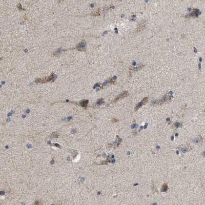 Immunohistochemistry-Paraffin: Pyruvate Dehydrogenase Phosphatase/PDP1/PPM2C Antibody [NBP1-87308]