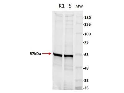 Western Blot: Pyruvate Kinase Antibody [NBP2-44231]
