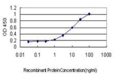 ELISA: QARS Antibody (5F5) [H00005859-M01]