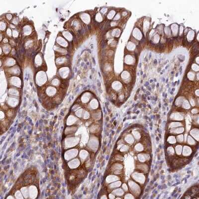 Immunohistochemistry-Paraffin: QARS Antibody [NBP2-37883]