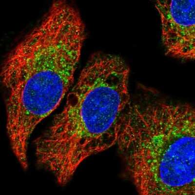 Immunocytochemistry/ Immunofluorescence: QDPR Antibody [NBP2-32408]