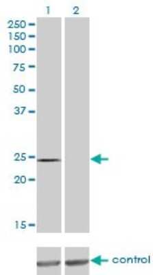 Western Blot: QDPR Antibody (M1) [H00005860-M02]