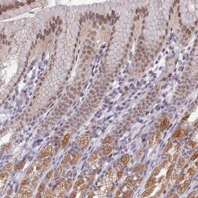 Immunohistochemistry-Paraffin: QIL1 Antibody [NBP1-80966]